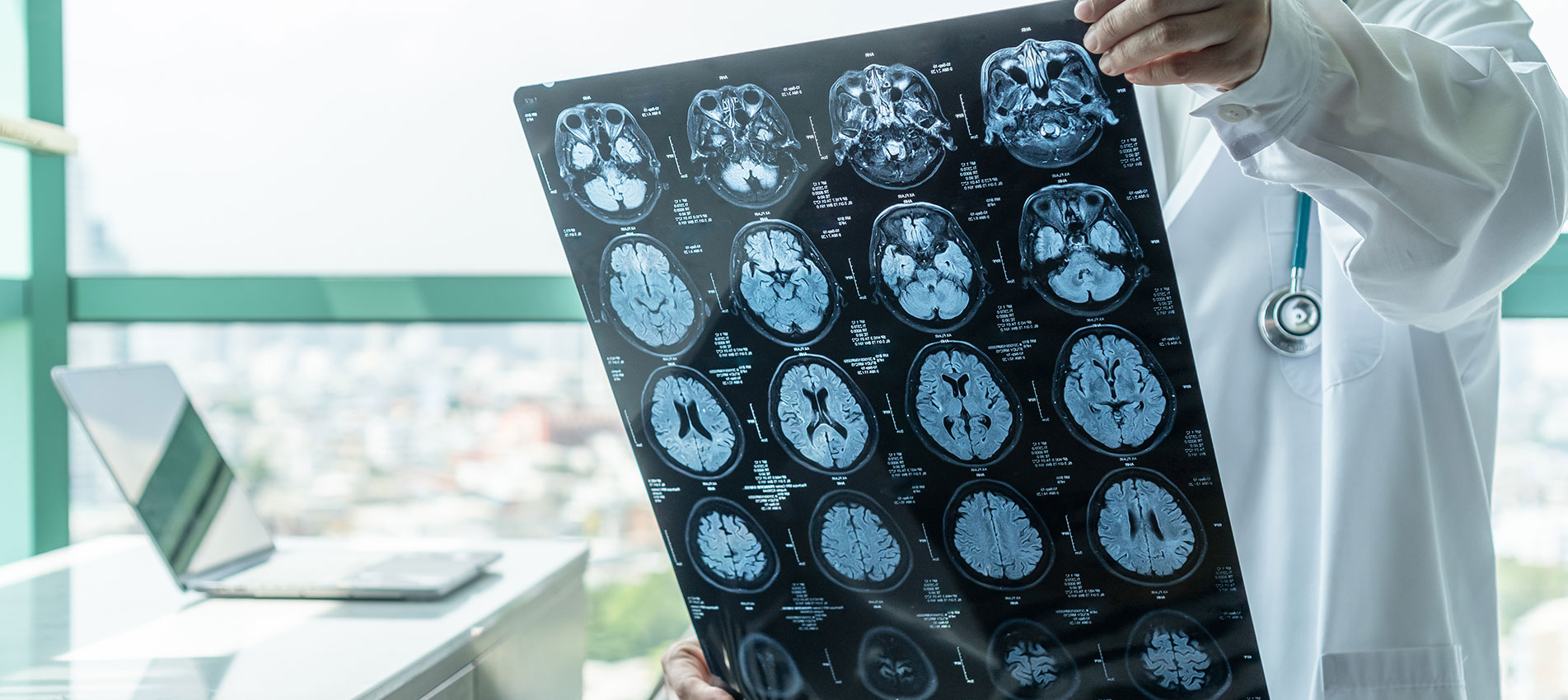 Doctor analyzing a patients brain x-ray results