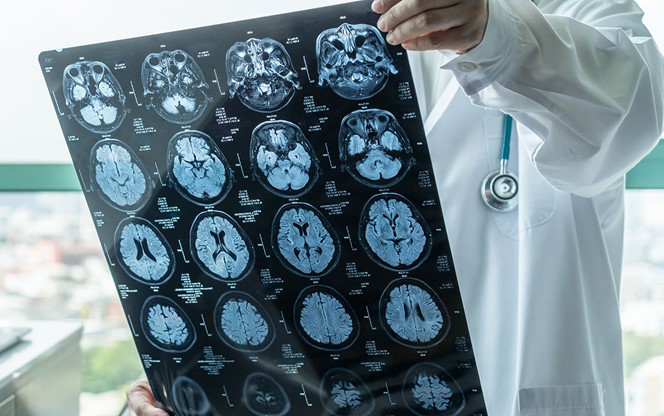 Doctor analyzing a patients brain x-ray results