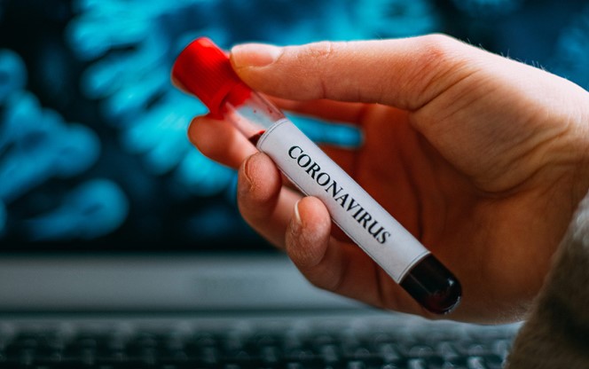 Coronavirus Blood Sample